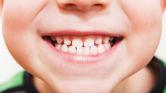 اهمية العناية بأسنان الأطفال في عمر مبكر